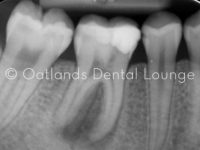 Before - Oatlands Dental Lounge