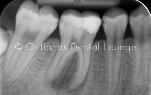 Before - Oatlands Dental Lounge