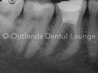 Before - Oatlands Dental Lounge