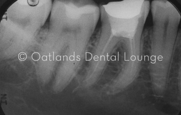 Before - Oatlands Dental Lounge