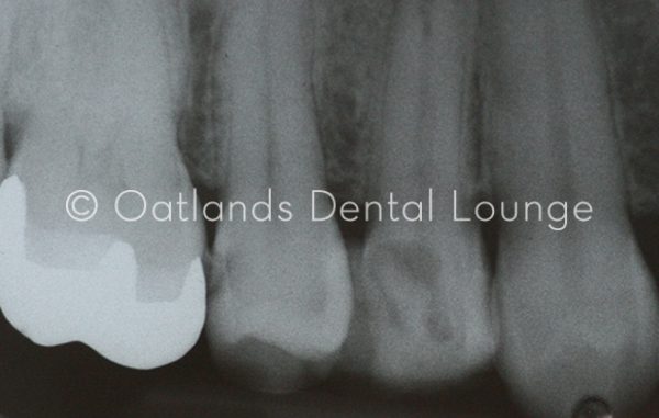 Before - Oatlands Dental Lounge