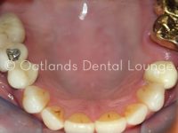 Before - Oatlands Dental Lounge