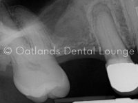 Before - Oatlands Dental Lounge