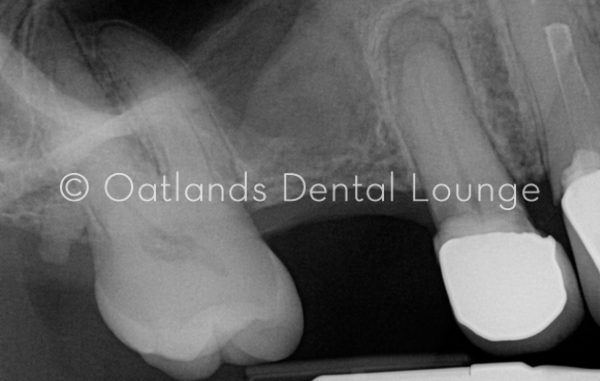 Before - Oatlands Dental Lounge