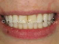 Before - Oatlands Dental Lounge