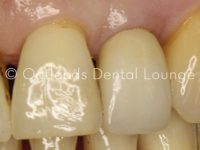 Before - Oatlands Dental Lounge