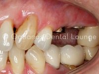 Before - Oatlands Dental Lounge