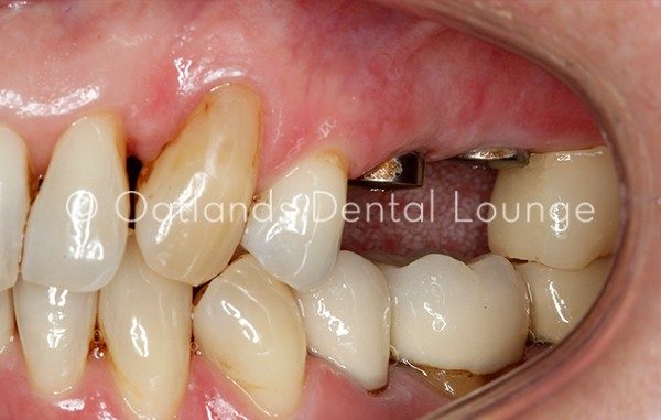 Before - Oatlands Dental Lounge