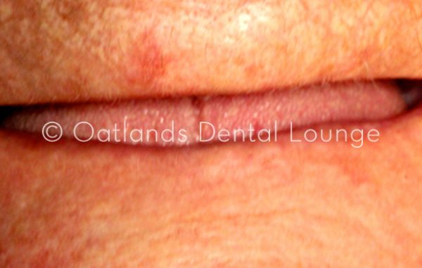 Before - Oatlands Dental Lounge