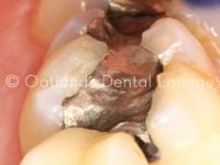 Before - Oatlands Dental Lounge