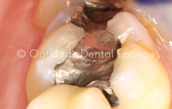 Before - Oatlands Dental Lounge
