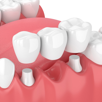 Treatment - Oatlands Dental Lounge