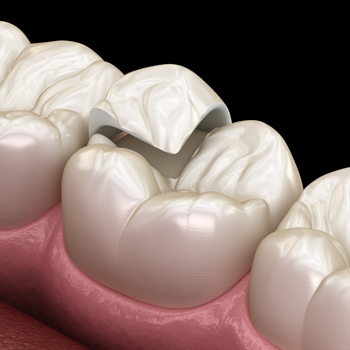 Treatment - Oatlands Dental Lounge