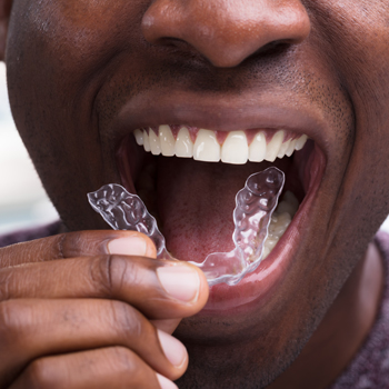 Treatment - Oatlands Dental Lounge