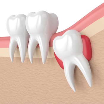 Treatment - Oatlands Dental Lounge