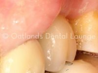 After - Oatlands Dental Lounge