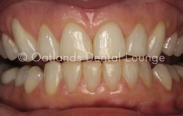 After - Oatlands Dental Lounge