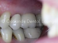 After - Oatlands Dental Lounge