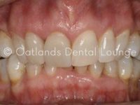 After - Oatlands Dental Lounge