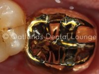 After - Oatlands Dental Lounge