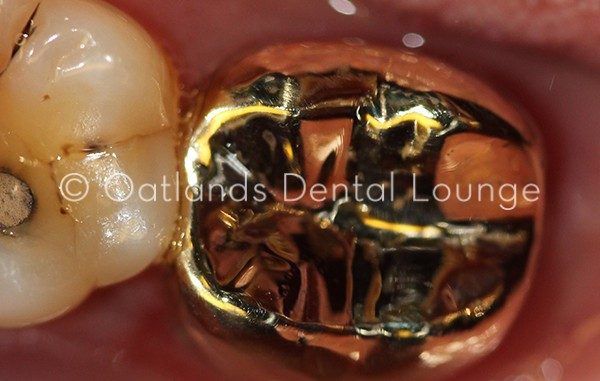 After - Oatlands Dental Lounge