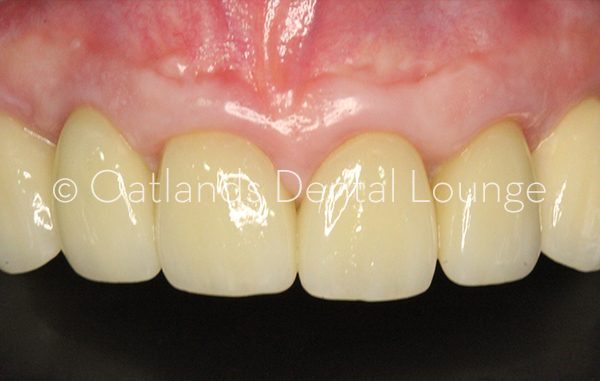 After - Oatlands Dental Lounge