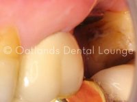 Before - Oatlands Dental Lounge
