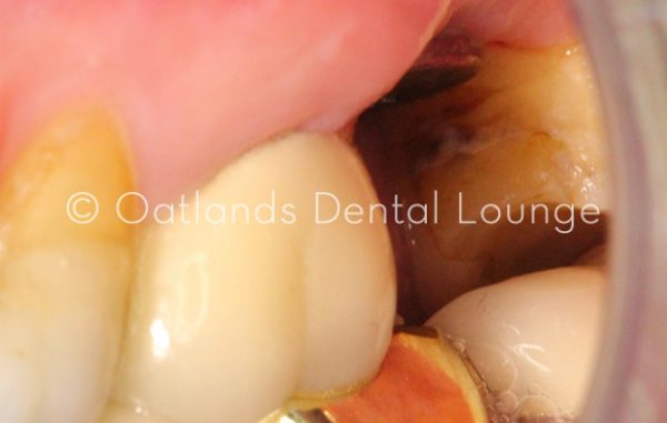 Before - Oatlands Dental Lounge