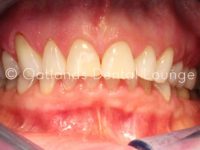 Before - Oatlands Dental Lounge