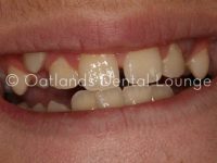 Before - Oatlands Dental Lounge