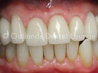 After - Oatlands Dental Lounge