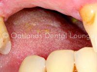 Before - Oatlands Dental Lounge