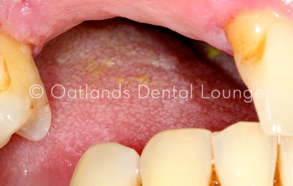 Before - Oatlands Dental Lounge