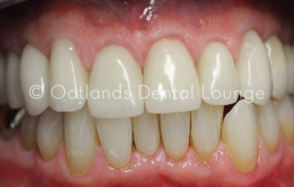 After - Oatlands Dental Lounge