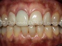 Before - Oatlands Dental Lounge