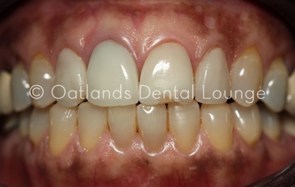 Before - Oatlands Dental Lounge