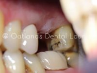 Before - Oatlands Dental Lounge