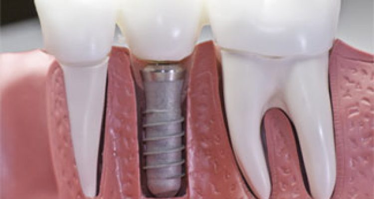 Blog - Oatlands Dental Lounge