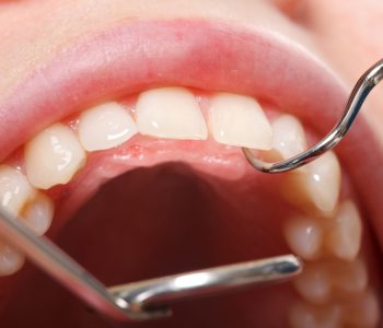 Blog - Oatlands Dental Lounge